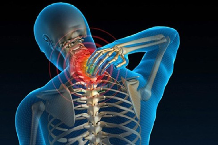 Thoái hóa cột sống